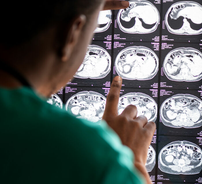 Internautas divididos após estudo revelar que hábito praticado por 18 milhões de americanos pode causar danos cerebrais permanentes