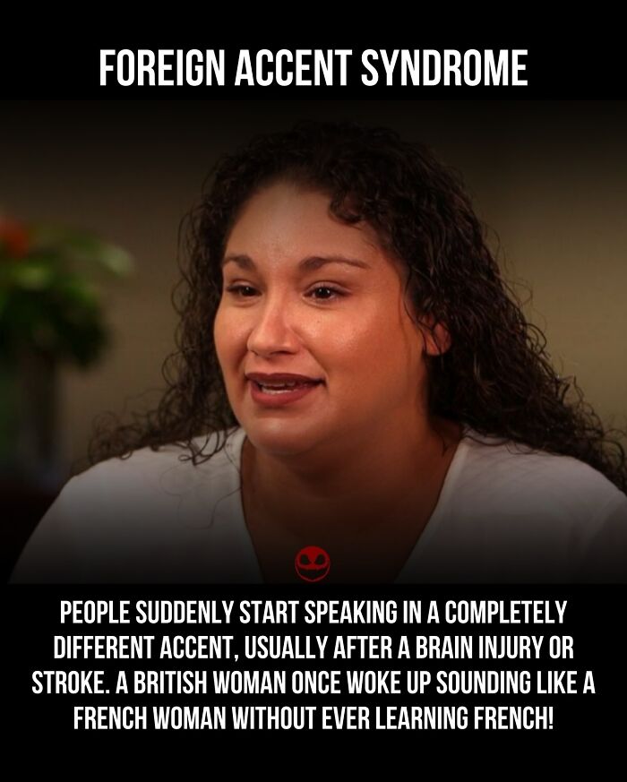 Woman explaining foreign accent syndrome, a weird and odd fact about brain injury causing sudden accent changes.