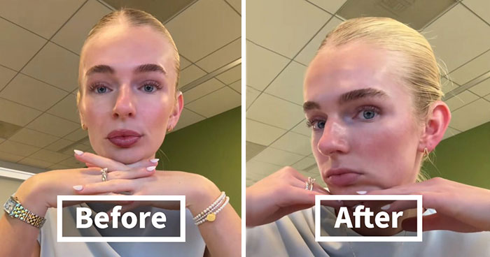 “A Victim Of Office Air”: People Reveal The Glow-Downs That They Experience After A Day In The Office