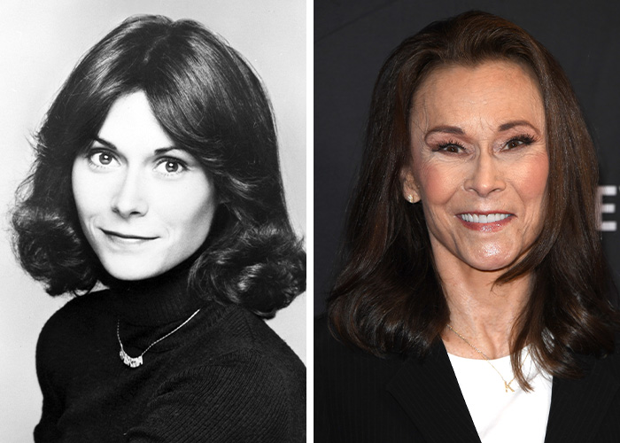 Side-by-side images of the original Charlieās Angels star, highlighting rumored plastic surgery transformations. Side-by-side images of the original Charlieās Angels star, highlighting rumored plastic surgery transformations.