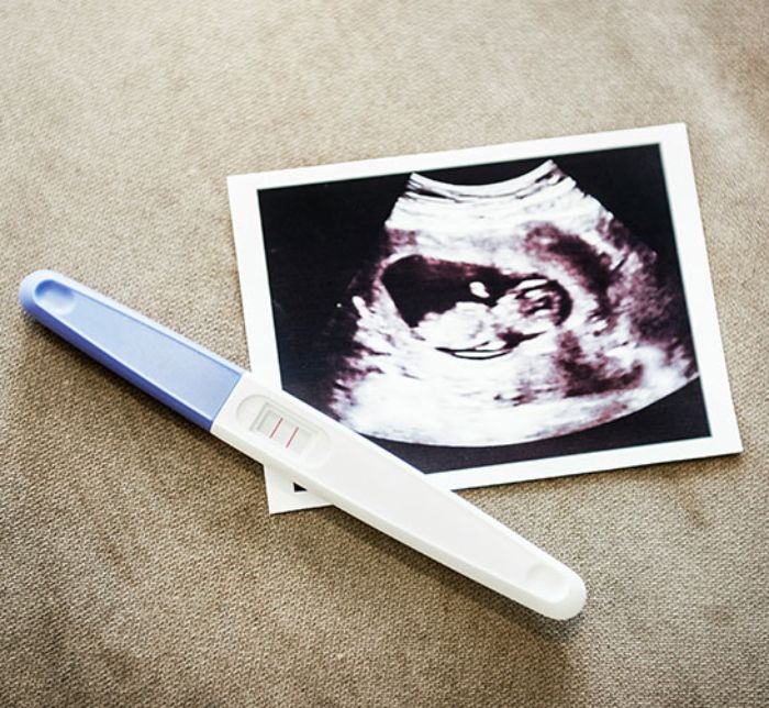 Teste de gravidez e imagem de ultrassom mostrando gravidez em estágio inicial relacionada a um sintoma bizarro de gravidez compartilhado pela mulher. Teste de gravidez e imagem de ultrassom mostrando gravidez em estágio inicial relacionada a um sintoma bizarro de gravidez compartilhado pela mulher.