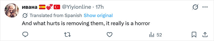 Tweet from a woman translated from Spanish, expressing the pain of tattoo removal, referencing a difficult tattoo removal transformation. Tweet from a woman translated from Spanish, expressing the pain of tattoo removal, referencing a difficult tattoo removal transformation.