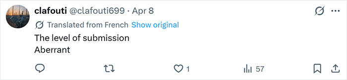 52YO woman’s tattoo removal transformation after partner forced 250 tattoos of his name onto her arm. 52YO woman’s tattoo removal transformation after partner forced 250 tattoos of his name onto her arm.