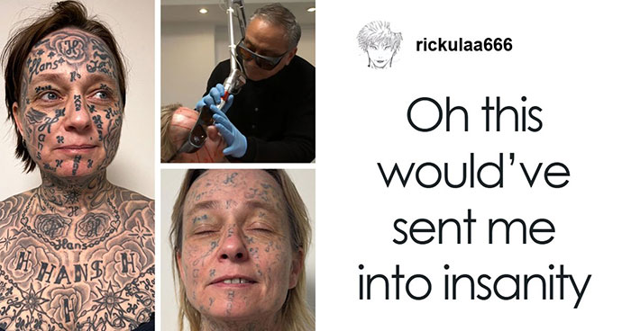 “Trying To Overwrite A Human Being”: 52YO Woman Forced Into 250 Tattoos Begins Removal Journey, Stuns Internet