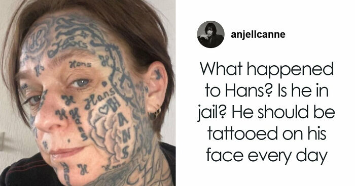 After Partner Forced 250 Tattoos Of His Name Onto Her, 52YO Woman’s Tattoo Removal Transformation Stuns