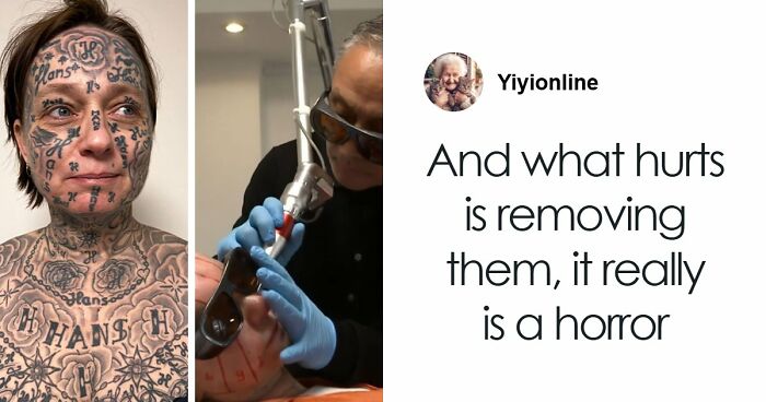 After Partner Forced 250 Tattoos Of His Name Onto Her, 52YO Woman’s Tattoo Removal Transformation Stuns