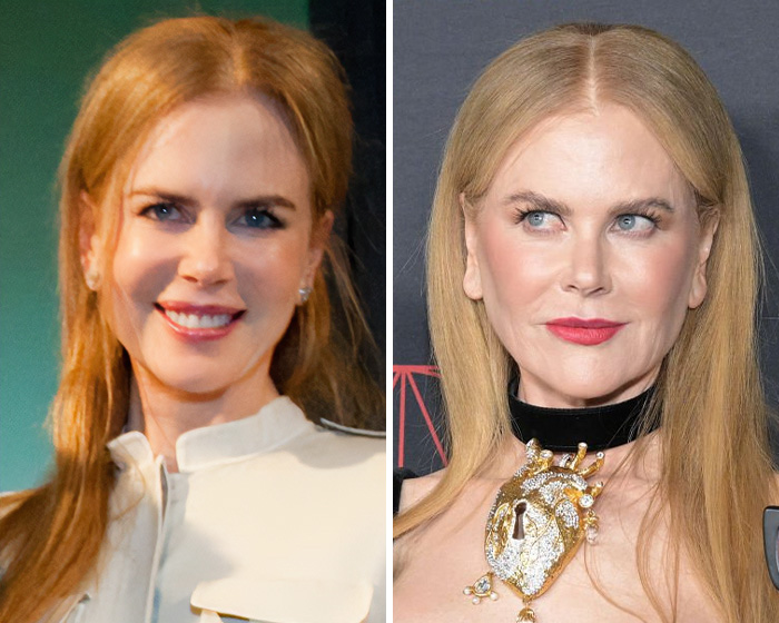 All The Signs Pointing To Your Coworker’s Secret Plastic Surgery, From Bat Ears To Bunny Nose And A Hairstyle Change All The Signs Pointing To Your Coworker’s Secret Plastic Surgery, From Bat Ears To Bunny Nose And A Hairstyle Change