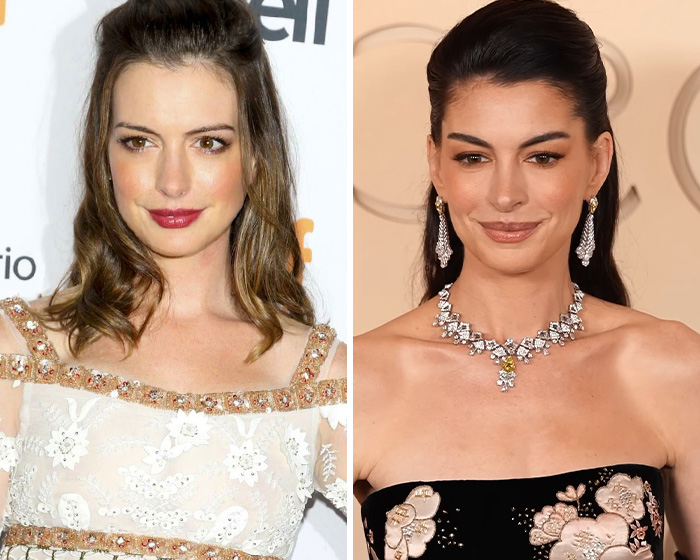 All The Signs Pointing To Your Coworker’s Secret Plastic Surgery, From Bat Ears To Bunny Nose And A Hairstyle Change All The Signs Pointing To Your Coworker’s Secret Plastic Surgery, From Bat Ears To Bunny Nose And A Hairstyle Change