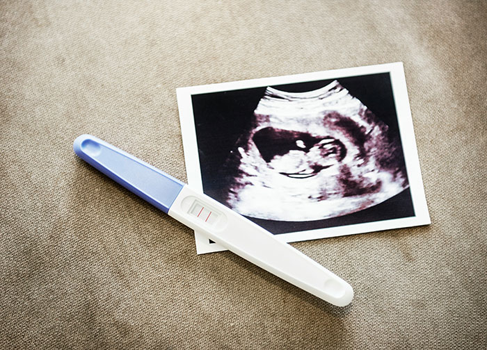 Pregnancy test showing positive result next to an ultrasound image, related to identical twins and paternity case update.