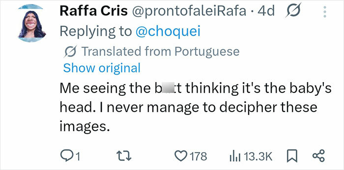 Tweet screenshot of a user discussing confusion about interpreting an image of a pregnant doctor showing her baby peeing inside the womb.