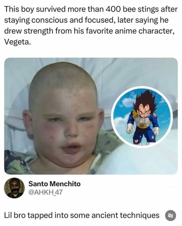 Boy who survived 400 bee stings credits favorite anime character with strength in funny tweet for laughs.