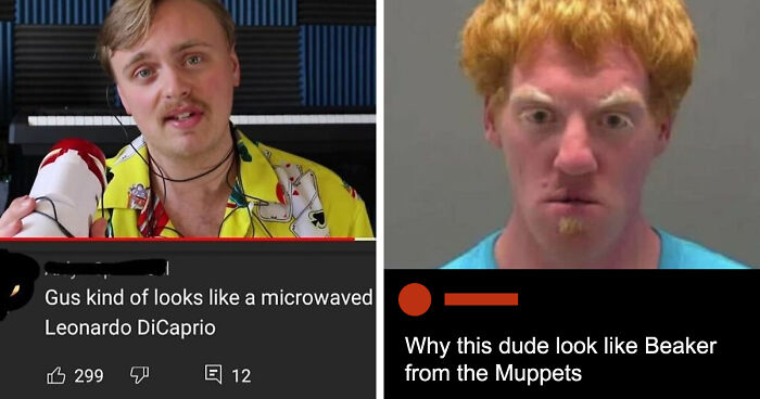 63 Rare Burns That Hit So Hard, People Didn’t Even Know How To Respond