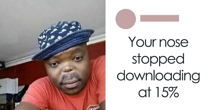 63 Rare Burns That Hit So Hard, People Didn’t Even Know How To Respond