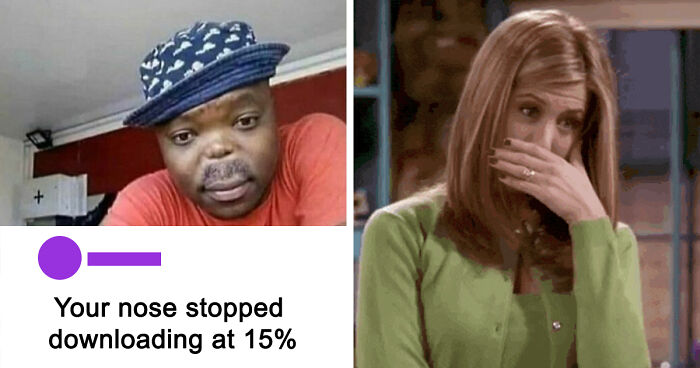 63 Rare Burns That Hit So Hard, People Didn’t Even Know How To Respond