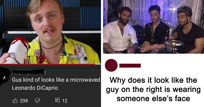 63 Rare Burns That Hit So Hard, People Didn’t Even Know How To Respond