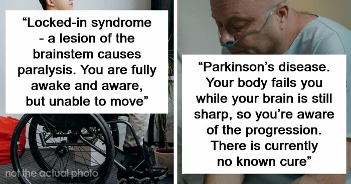 Medical Experts Share The Most Frightening Illnesses Ever In This Viral Online Thread (20 Answers)