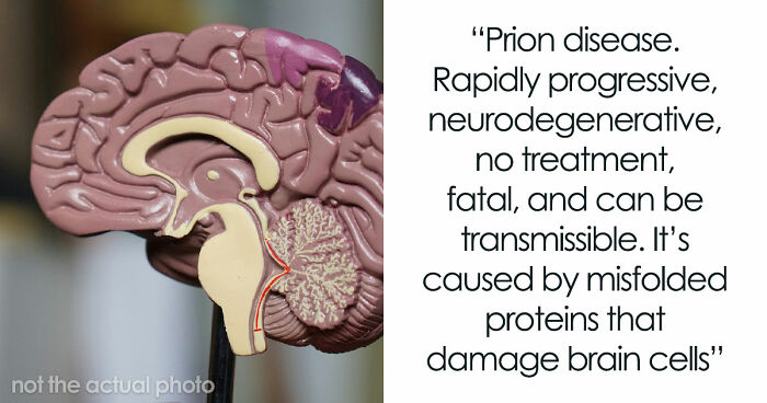 Medical Experts Share The Most Frightening Illnesses Ever In This Viral Online Thread (20 Answers)