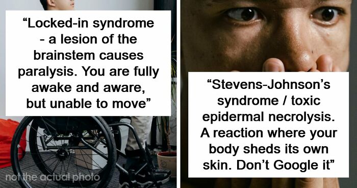 Medical Experts Share The Most Frightening Illnesses Ever In This Viral Online Thread (20 Answers)