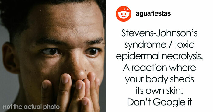 Medical Experts Share The Most Frightening Illnesses Ever In This Viral Online Thread (20 Answers)