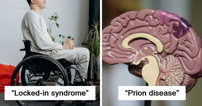 Medical Experts Share The Most Frightening Illnesses Ever In This Viral Online Thread (20 Answers)
