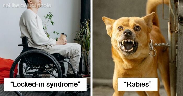 Medical Experts Share The Most Frightening Illnesses Ever In This Viral Online Thread (20 Answers)