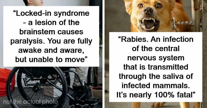 Medical Experts Share The Most Frightening Illnesses Ever In This Viral Online Thread (20 Answers)
