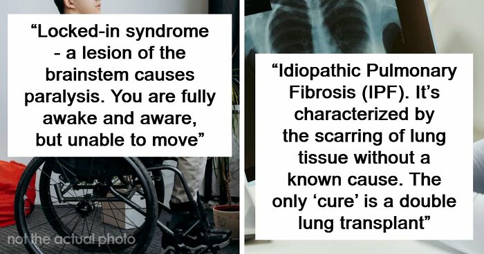 Medical Experts Share The Most Frightening Illnesses Ever In This Viral Online Thread (20 Answers)