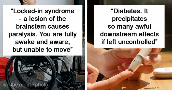 Medical Experts Share The Most Frightening Illnesses Ever In This Viral Online Thread (20 Answers)