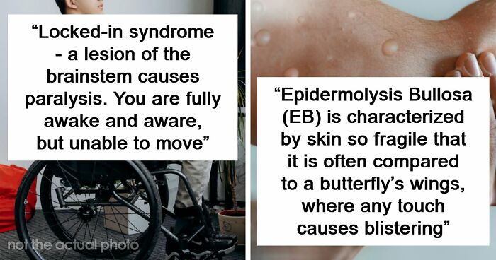 Medical Experts Share The Most Frightening Illnesses Ever In This Viral Online Thread (20 Answers)