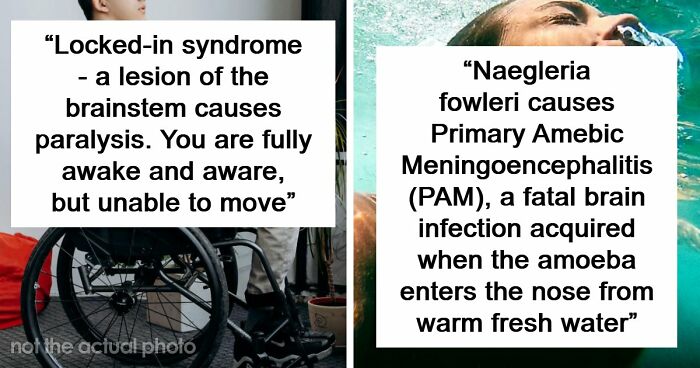 Medical Experts Share The Most Frightening Illnesses Ever In This Viral Online Thread (20 Answers)