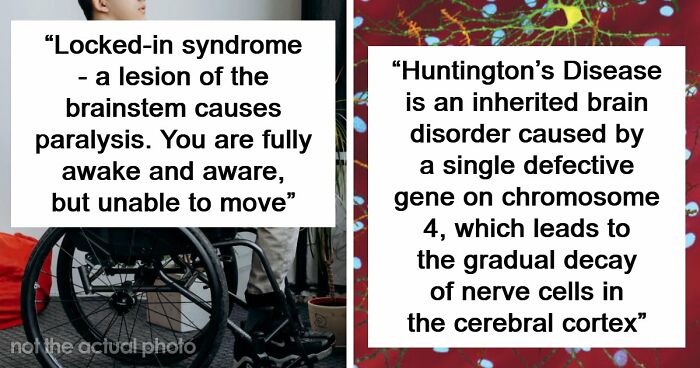 Medical Experts Share The Most Frightening Illnesses Ever In This Viral Online Thread (20 Answers)