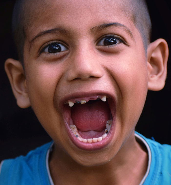 Close-up of a school kid with missing and crooked teeth, showing a wide open mouth, capturing a moment of playful weirdness.