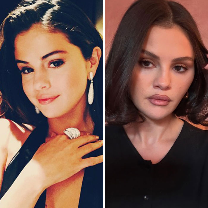 Selena Gomez Caught Leaving Clinic After Denying Plastic Surgery, Triggers Heated Reactions