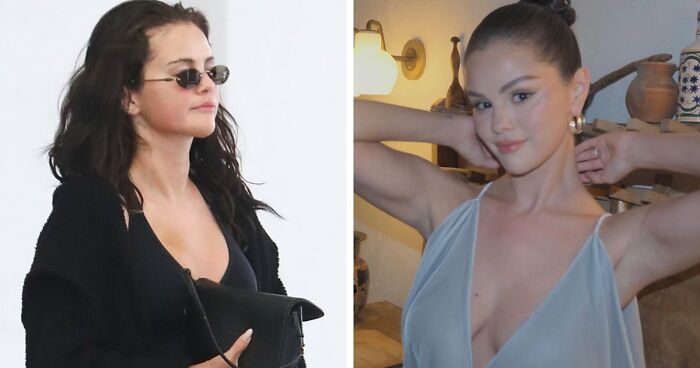 Selena Gomez Caught Leaving Clinic After Denying Plastic Surgery, Triggers Heated Reactions