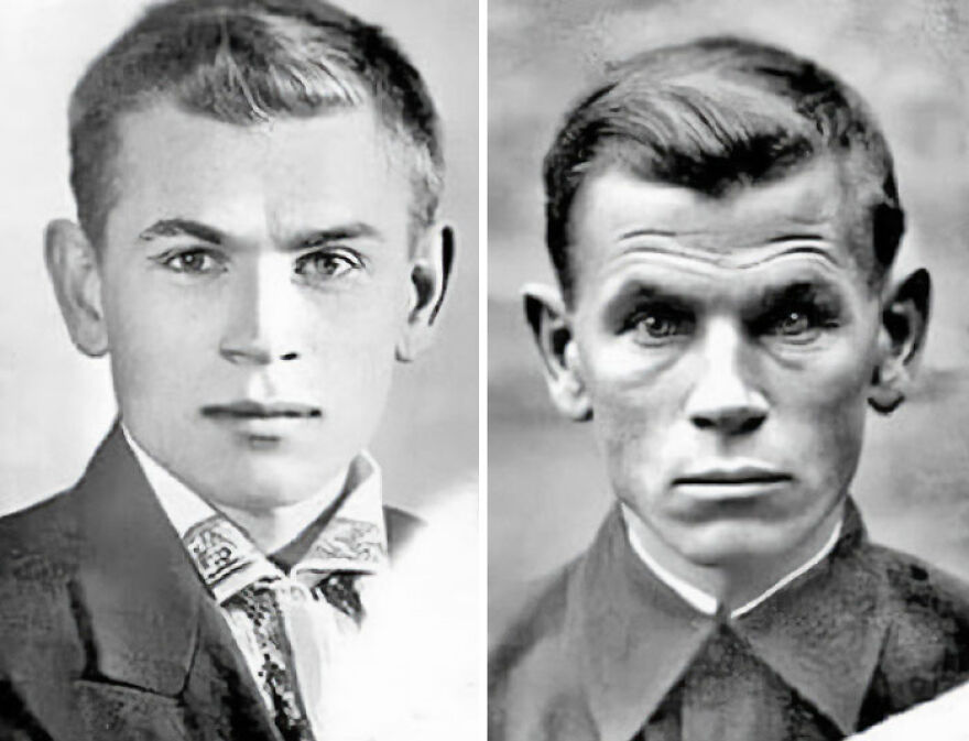 Two black and white photos of a man's face, showing a dramatic before and after change in appearance, offering fascinating photos and history.