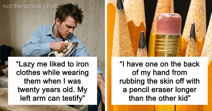 “Just To Prove I Was Tough”: Everyone Makes Mistakes, But These 47 People’s Stupid Injury Stories Hurt To Read