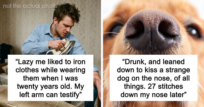 “Just To Prove I Was Tough”: Everyone Makes Mistakes, But These 47 People’s Stupid Injury Stories Hurt To Read