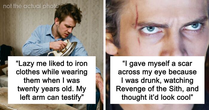 “Just To Prove I Was Tough”: Everyone Makes Mistakes, But These 47 People’s Stupid Injury Stories Hurt To Read