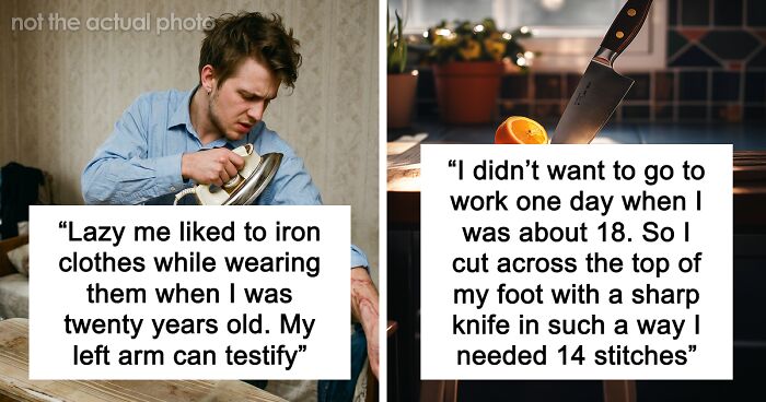 “Just To Prove I Was Tough”: Everyone Makes Mistakes, But These 47 People’s Stupid Injury Stories Hurt To Read