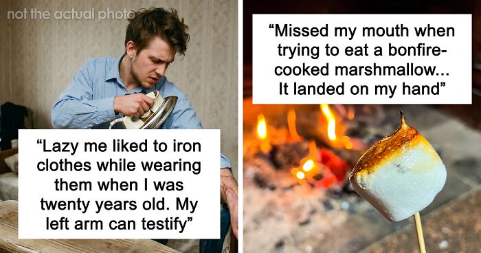 “Just To Prove I Was Tough”: Everyone Makes Mistakes, But These 47 People’s Stupid Injury Stories Hurt To Read