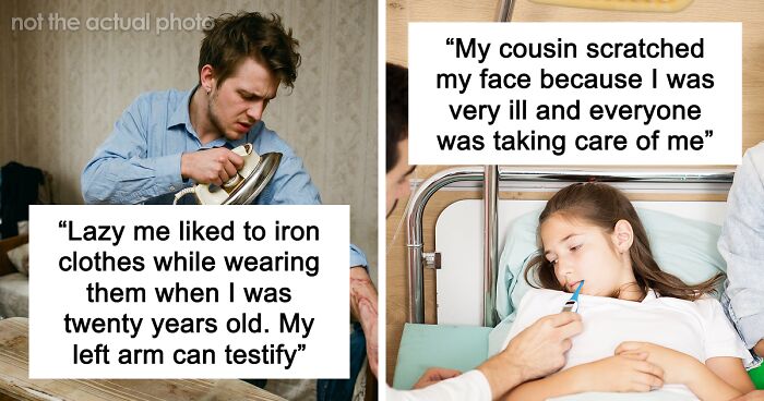 “Just To Prove I Was Tough”: Everyone Makes Mistakes, But These 47 People’s Stupid Injury Stories Hurt To Read