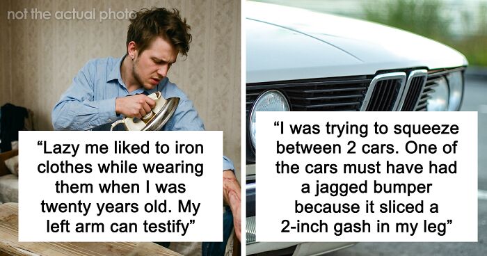“Just To Prove I Was Tough”: Everyone Makes Mistakes, But These 47 People’s Stupid Injury Stories Hurt To Read