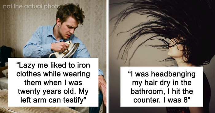 “Just To Prove I Was Tough”: Everyone Makes Mistakes, But These 47 People’s Stupid Injury Stories Hurt To Read