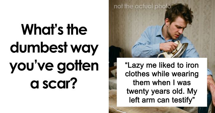 “Just To Prove I Was Tough”: Everyone Makes Mistakes, But These 47 People’s Stupid Injury Stories Hurt To Read