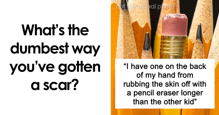 “Just To Prove I Was Tough”: Everyone Makes Mistakes, But These 47 People’s Stupid Injury Stories Hurt To Read