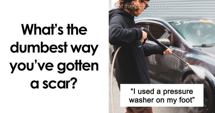 “Just To Prove I Was Tough”: Everyone Makes Mistakes, But These 47 People’s Stupid Injury Stories Hurt To Read