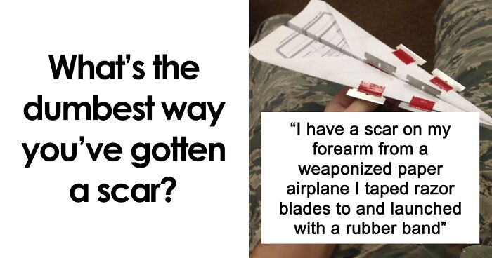 “Just To Prove I Was Tough”: Everyone Makes Mistakes, But These 47 People’s Stupid Injury Stories Hurt To Read