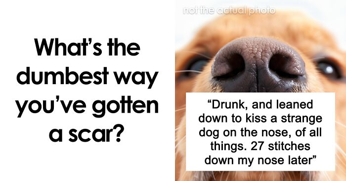“Just To Prove I Was Tough”: Everyone Makes Mistakes, But These 47 People’s Stupid Injury Stories Hurt To Read