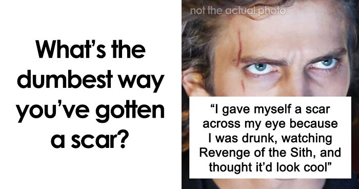 “Just To Prove I Was Tough”: Everyone Makes Mistakes, But These 47 People’s Stupid Injury Stories Hurt To Read