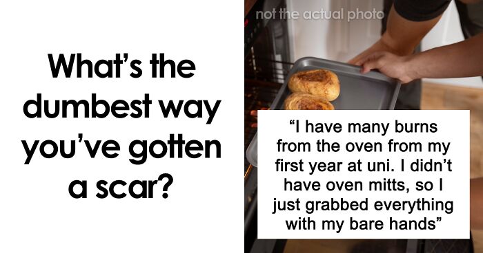 “Just To Prove I Was Tough”: Everyone Makes Mistakes, But These 47 People’s Stupid Injury Stories Hurt To Read